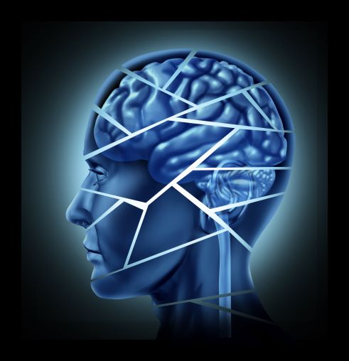 Chiropractic Neurology Addresses Symptoms of Vestibular Concussion