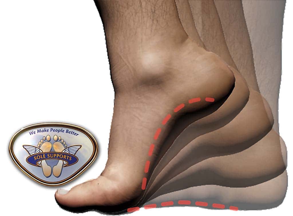 Custom Foot Orthotics for Pain - Relief 