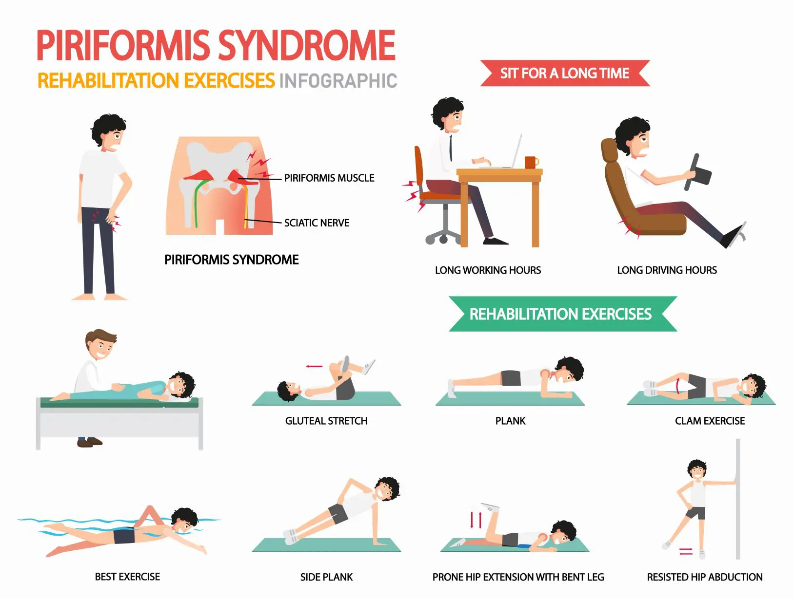 Information about Piriformis Syndrome