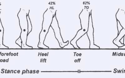 Abnormal Foot Biomechanics: What can Go Wrong?