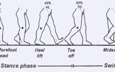 Abnormal Foot Biomechanics: What can Go Wrong?