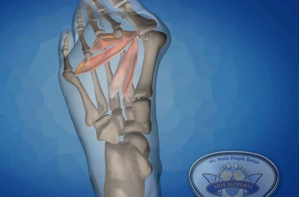 Causes and Treatment of Bunion Pain