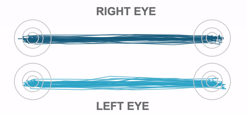 right left eye
